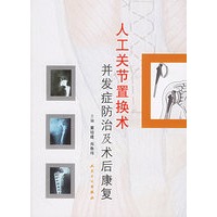 人工关节置换术并发症防治及术后康复