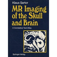 头颅MRI成像 MRI Imaging of the Skull and Brain