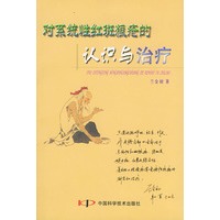 对系统性红斑狼疮的认识与治疗