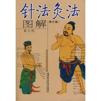 针法灸法图解