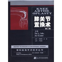 膝关节置换术（第二版）