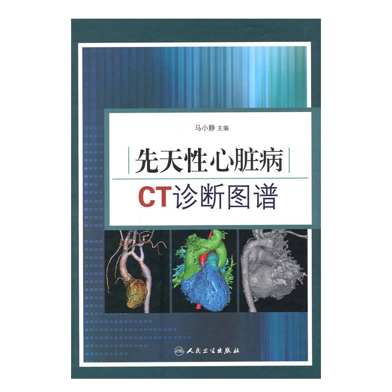 【先天性心脏病CT诊断图谱( 货号:711712787