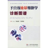 子宫颈液基细胞学诊断图谱